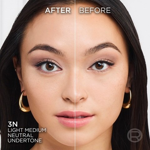 True Match Fondten Before After